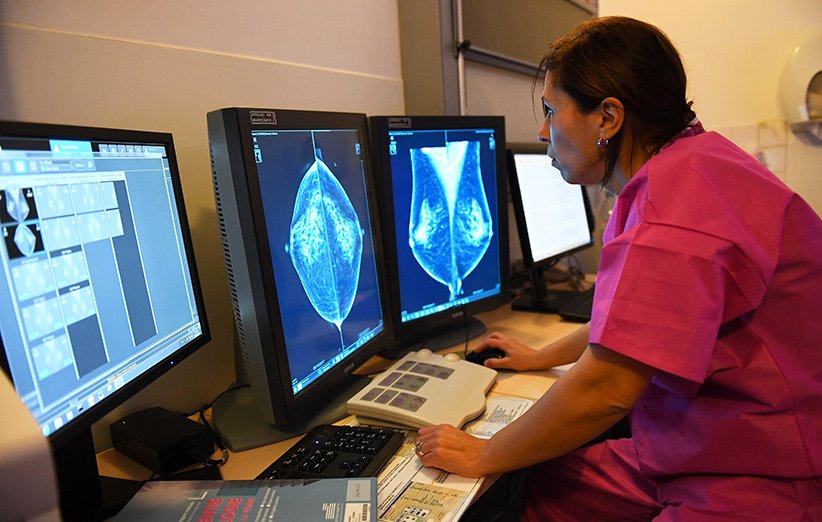 گوگل توانست انسان‌ها را در تشخیص سرطان سینه شکست دهد